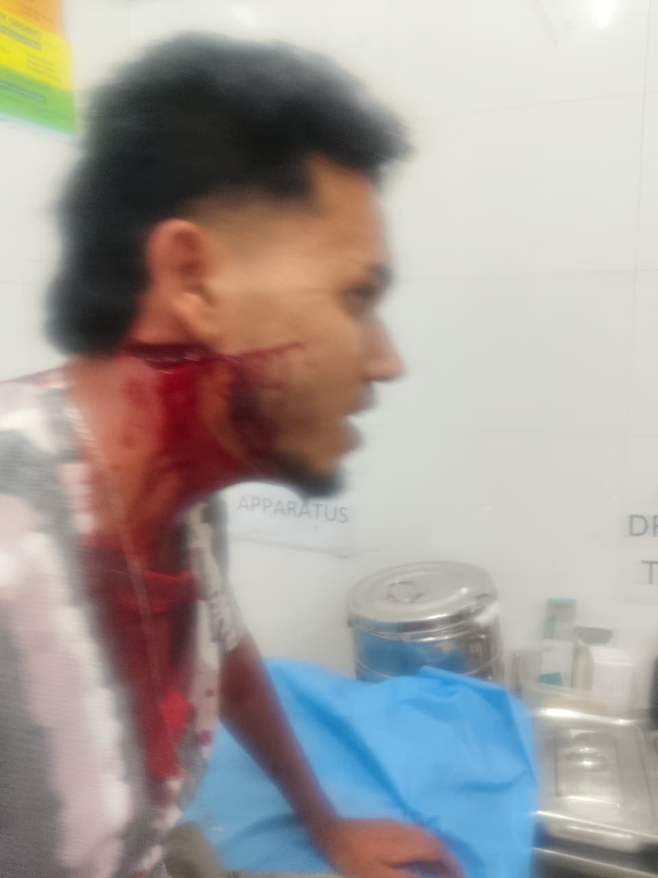 खानापूरात वाद मिटवायला गेलेल्या युवकावर चाकू हल्ला; आरोपी अटकेत, हिंडलगा कारागृहात रवानगी